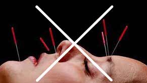 Tapping Acupuncture No Needles image
